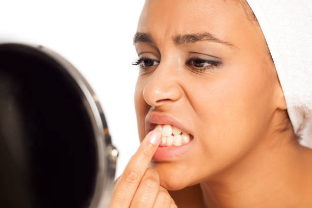 Lady holding touching a broken tooth