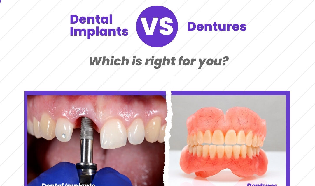 Dental Implants vs. Dentures: Which is Right for You?