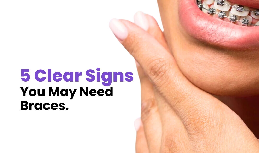 5 Clear Signs You May Need Braces.